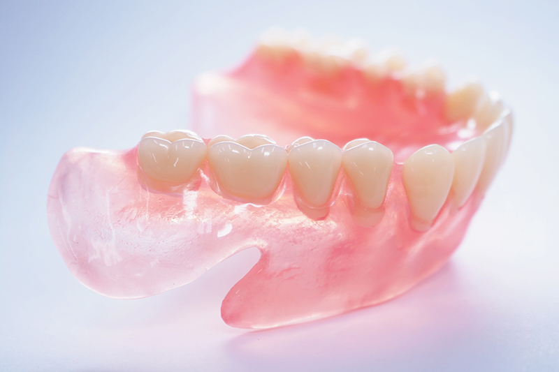 ノンクラスプデンチャー